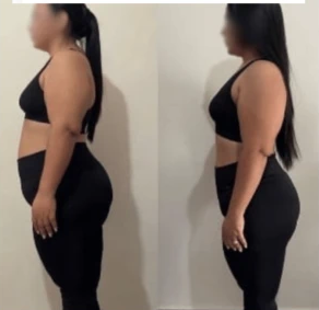 Resultado antes e depois