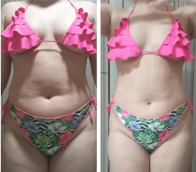 Resultado antes e depois