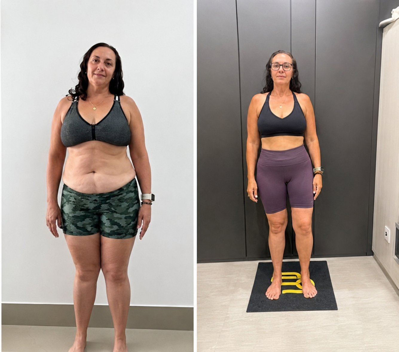 Antes e depois com melhora de composição corporal